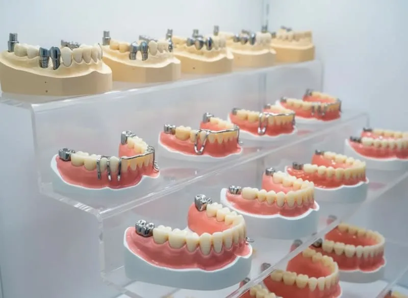 Bild zum Beitrag Zahnprothesen